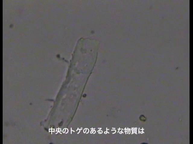 【ケムトレイル 資料室】(09.1.21) 降雨の中の微生物 (2) …Microbes in the rainfall (2)