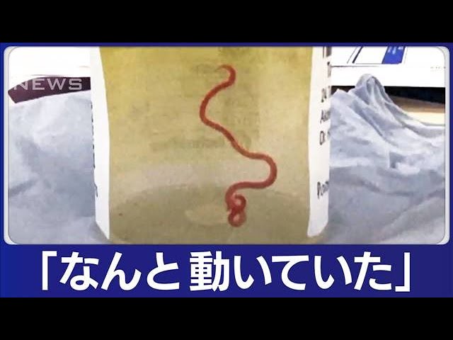 女性の脳から体長8センチの生きた寄生虫　MRI検査で異常発見し摘出(2023年8月30日)