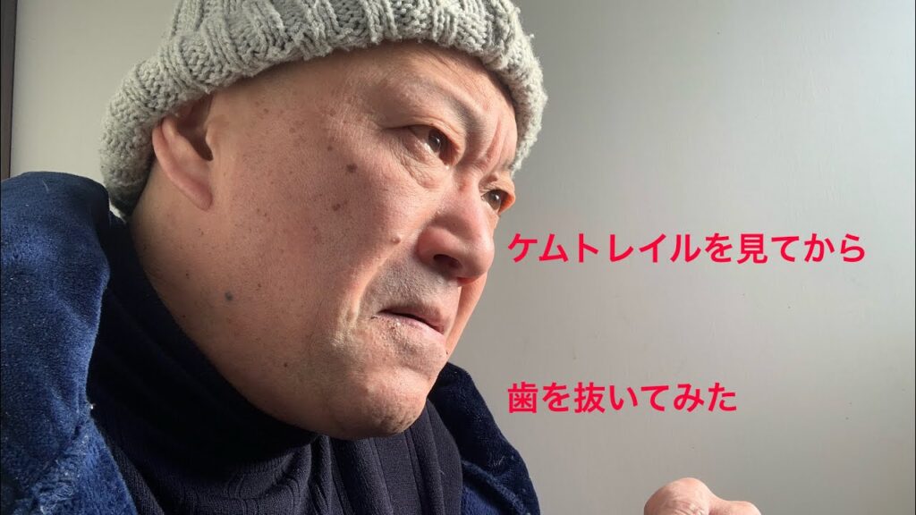 ケムトレイルを見てから歯を抜いてみた
